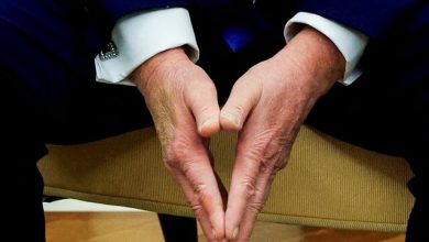 کبودی دست ترامپ بحثبرانگیز شد