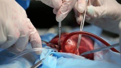 درج نشان «اهدای عضو» در گواهینامههای رانندگی