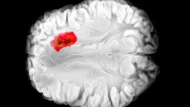 کشف دارویی برای مبارزه با کشنده‌ترین سرطان‌های مغز